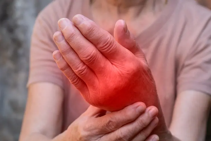 Inflamación de articulaciones de la mano